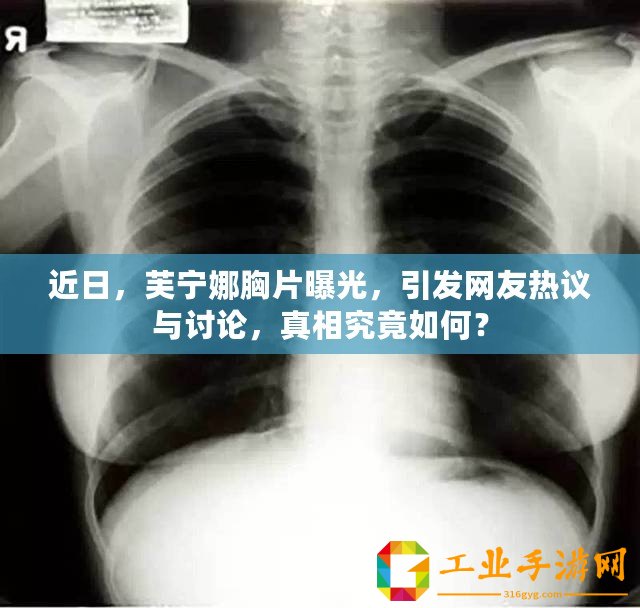 近日，芙寧娜胸片曝光，引發(fā)網(wǎng)友熱議與討論，真相究竟如何？