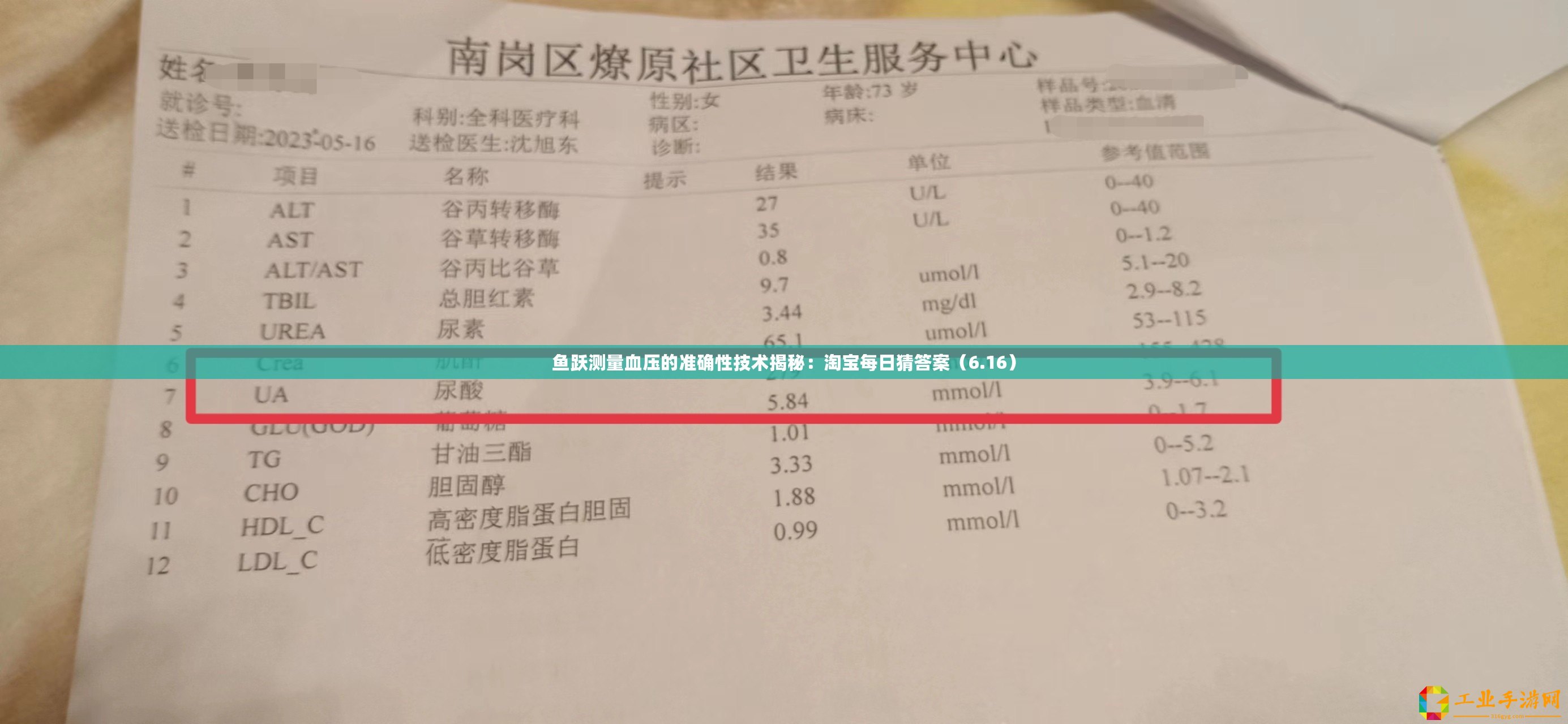魚躍測量血壓的準確性技術揭秘：淘寶每日猜答案（6.16）